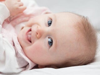 Baby lying down on bed with cradle cap on head