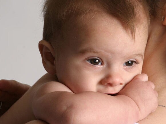 Reflux in Babies - Key Information