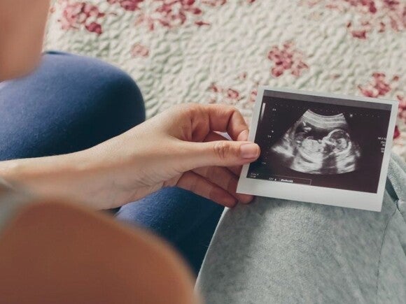 man and woman looking at pregnany scan